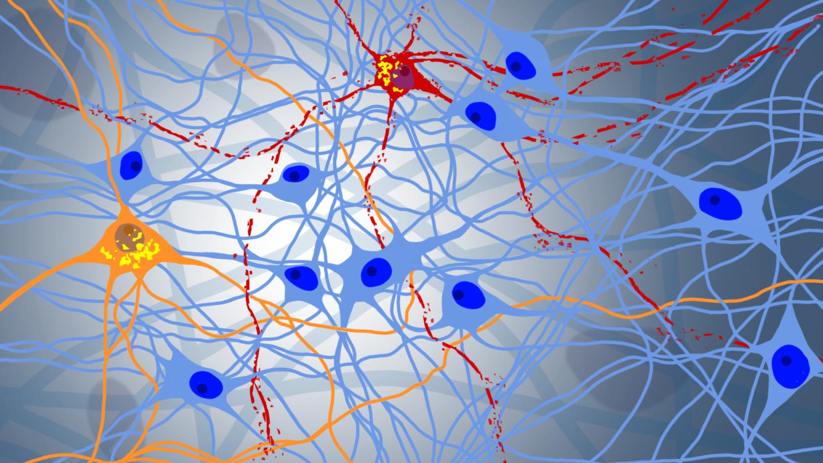 Digitale Zeichnung eines degenerierenden neuronalen Netzwerks