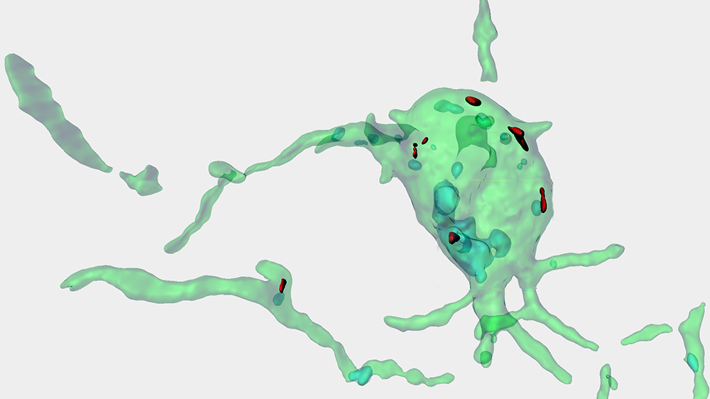 The illustration shows a computer-generated picture of a microglia cell.