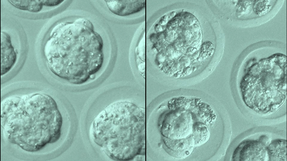 Das Bild zeigt Zellen eines wenige Tage alten embryonalen Zellhaufens: links mit funktionierendem Pramel7, rechts ohne das Eiweiss – die Entwicklung der Stammzellen bleibt stecken und die Embryonen sterben ab. (Bild: Paolo Cinelli, USZ)