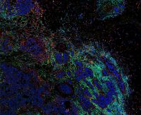 Das massgeblich an der Universität Zürich entwickelte Verfahren der bildgebenden Massenzytometrie erzeugt hochaufgelöste digitale Bilder von Gewebeschnitten.
