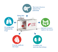 The perfusion machine replaces the functions of various organs in order to keep the donor liver alive outside of the body. (USZ)