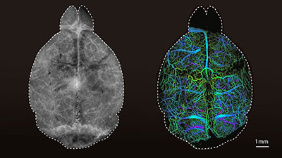 Fluoreszenzbilder eines Mausgehirns