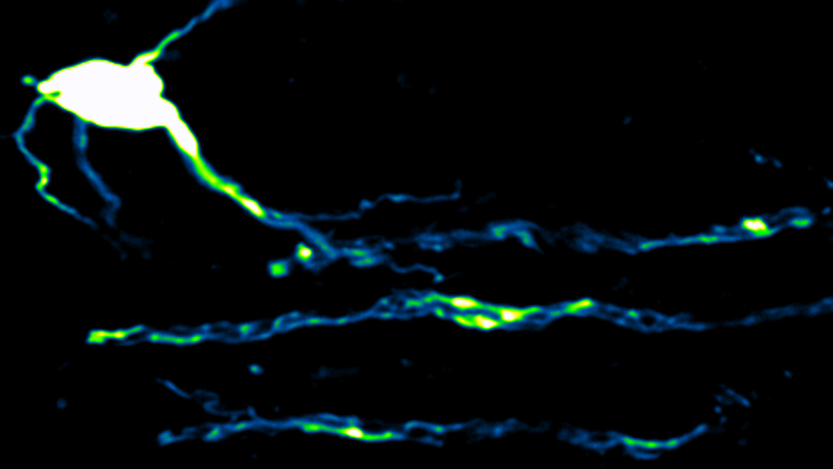Fluorescence microscopic image of a single oligodendrocyte