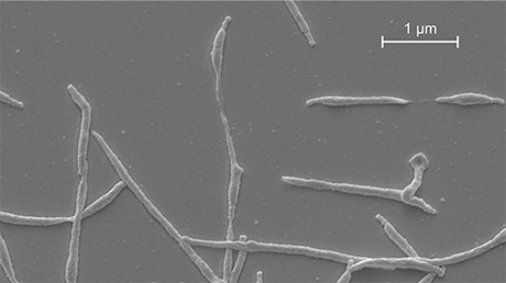 The image shows an electron micrograph of the bacterium Mycoplasma pneumoniae.