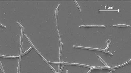 Das Bild zeigt eine elektronenmikroskopische Aufnahme des Bakteriums Mycoplasma pneumoniae.