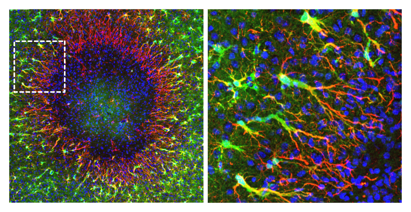 The image shows a brain injury, captured using two-photon microscopy