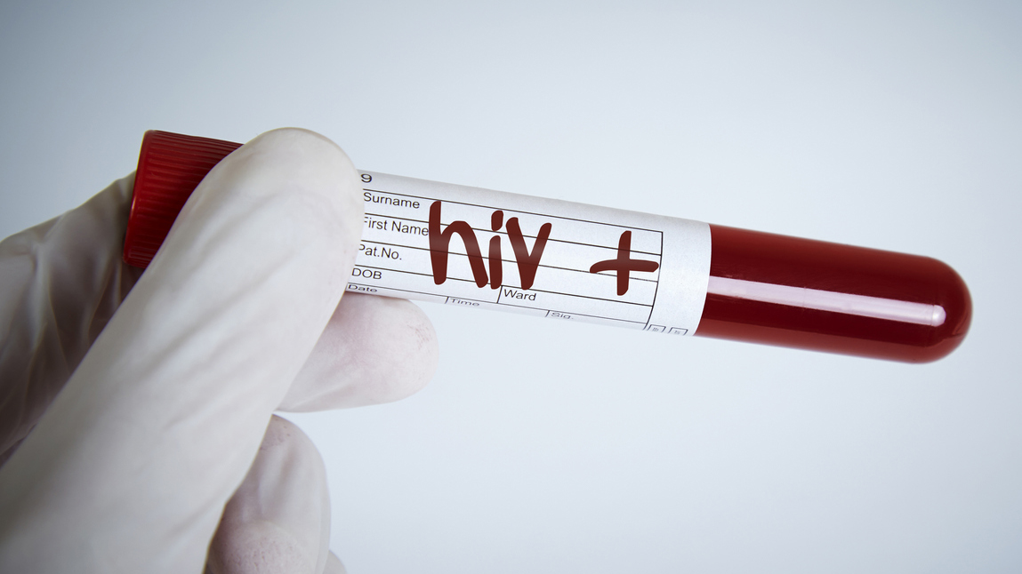 HIV Probe