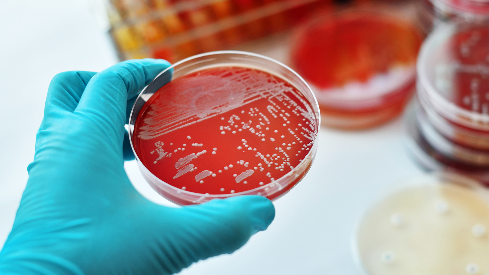 Bakterie in Petrischale