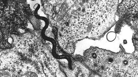 The image shows an electron micrograph of a Treponoma bacterium between two host cells.