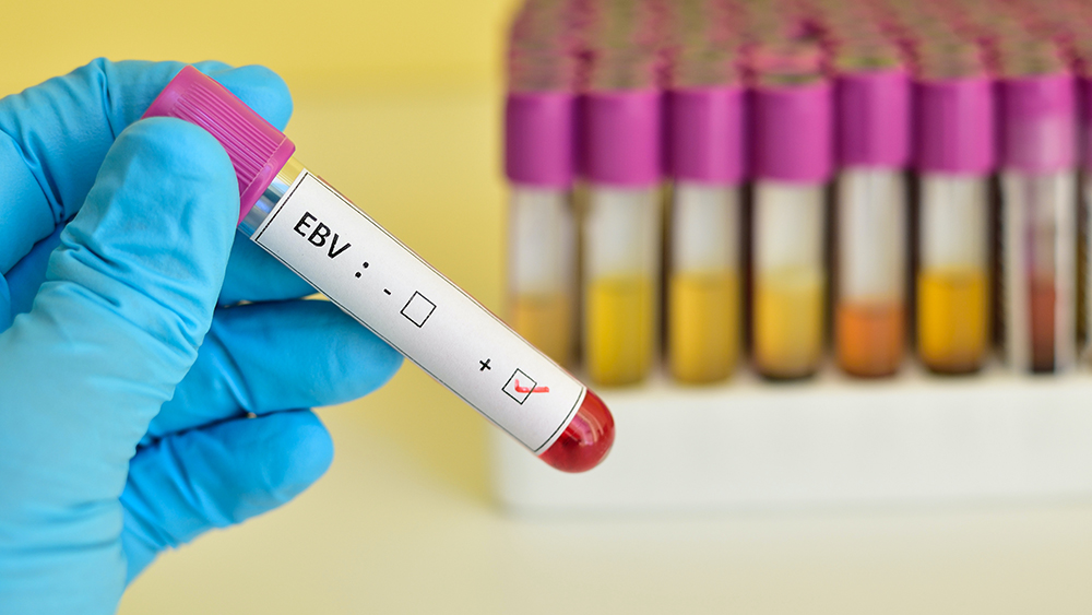 Teströhrchen Epstein-Barr-Virus
