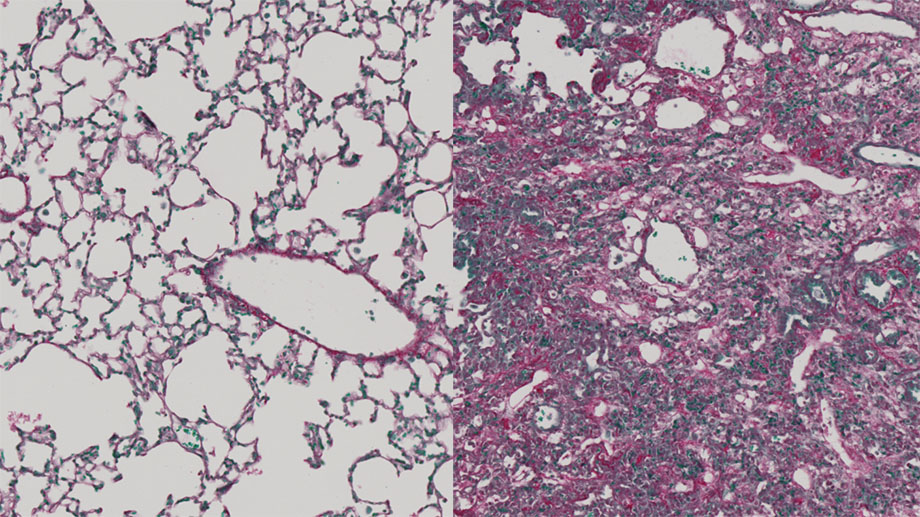 Gesundes Lungengewebe enthält viele luftgefüllte Lungenbläschen, in denen Sauerstoff aus der Atemluft ins Blut aufgenommen wird (links). In fibrotischem Lungengewebe wurden diese durch Bindegewebswucherungen verdrängt (rechts). (Bild: Christian Stockmann, UZH)