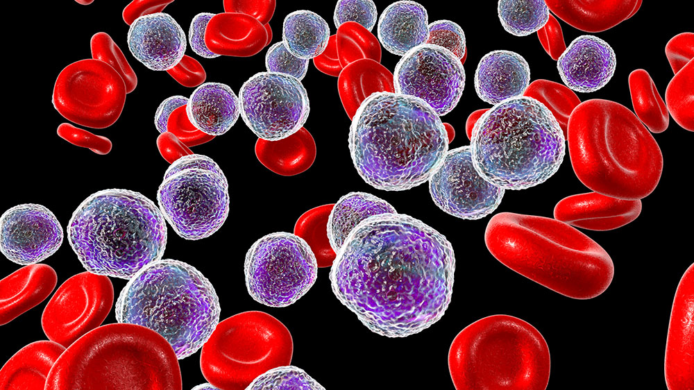 Blutkrebszellen